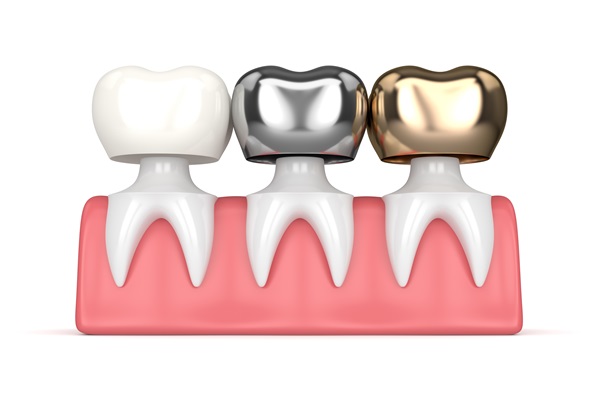 How Does A Dentist Prepare A Tooth For A Dental Crown?