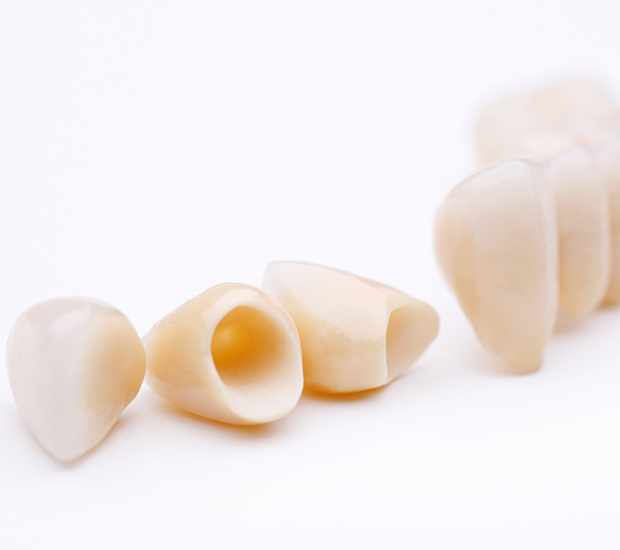 Torrance Dental Crowns and Dental Bridges