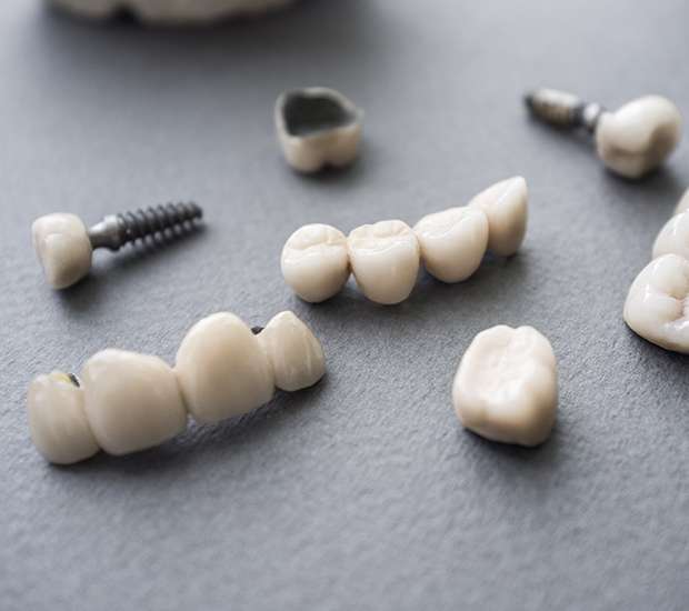 Torrance The Difference Between Dental Implants and Mini Dental Implants